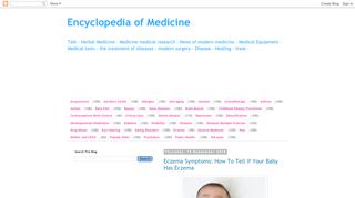 لقطة شاشة لموقع Encyclopedia of Medicine
بتاريخ 21/09/2019
بواسطة دليل مواقع ألتدتك
